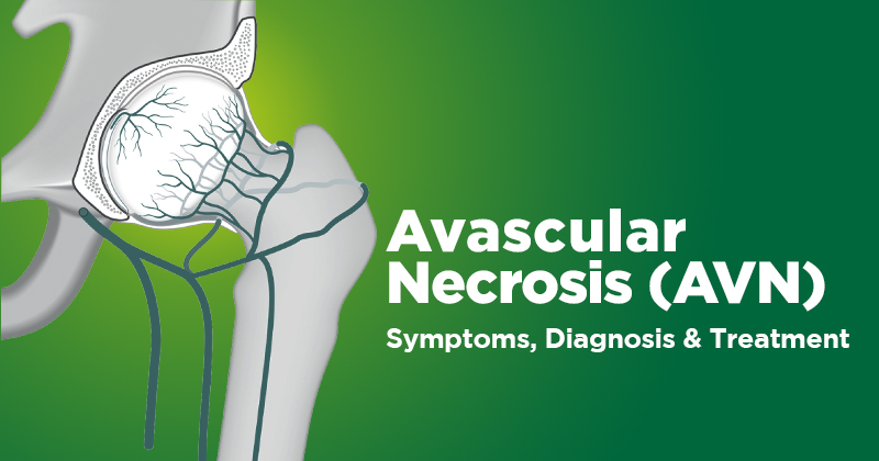 Avascular Necrosis Symptoms Diagnosis Treatment